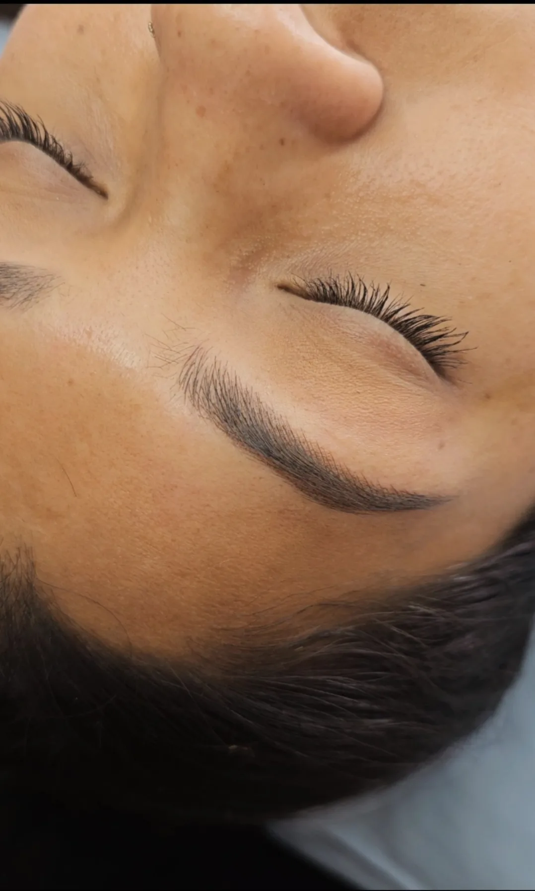 Healed brows, eyes closed